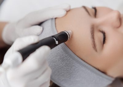 MEDICAL DERMO – Ihr Kosmetikstudio in Hannover 18 HydraFacial